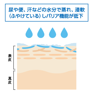 看護・介護のスキンケア ステップ1