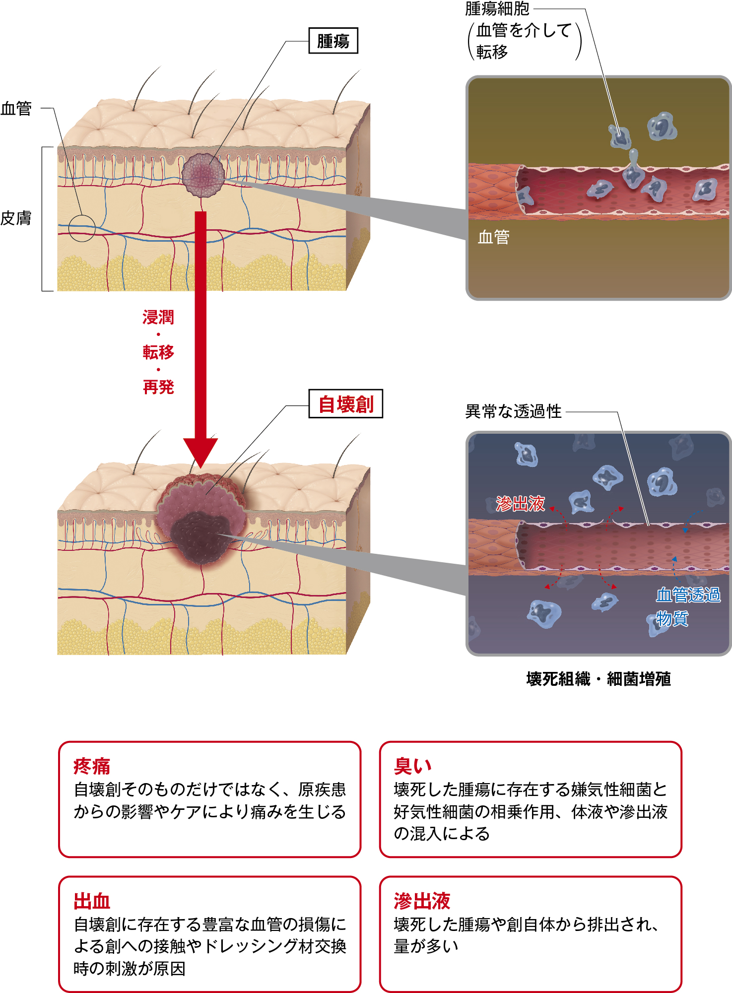 自壊創とは