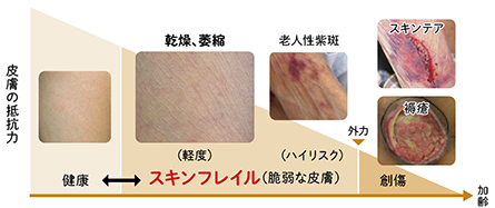 高齢者のスキンフレイルとは